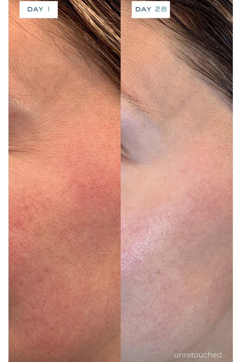O2 Niacinamide Serum Home & Away Duo $510 Value, Alternate, color, NO COLOR