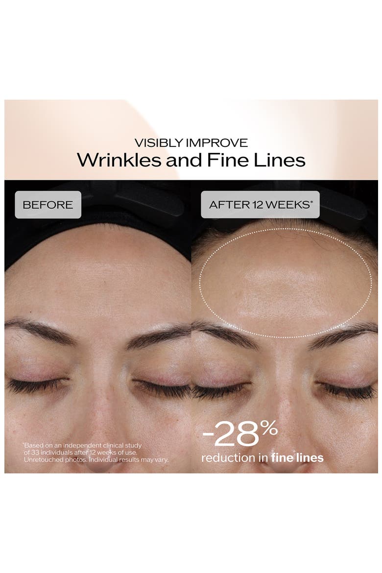 Benefiance Dark Spot & Wrinkle Serum, Alternate, color, NO COLOR