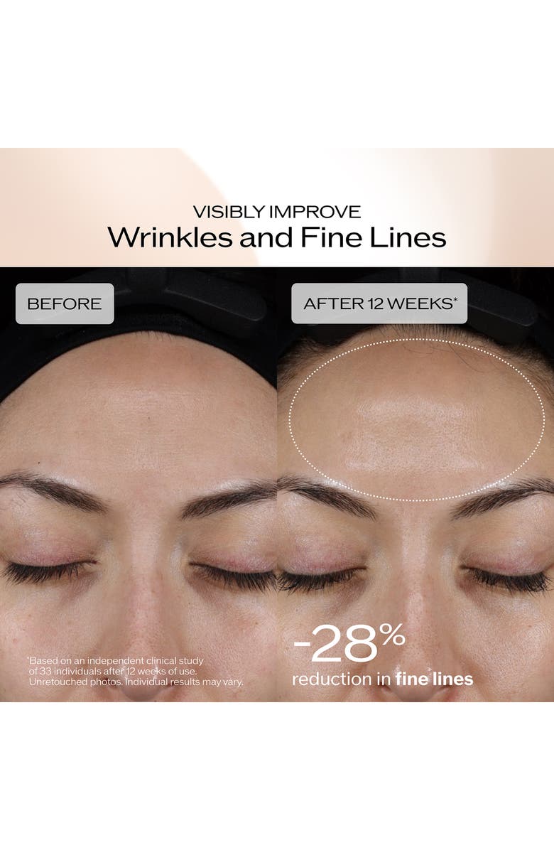 Shiseido Benefiance Dark Spot & Wrinkle Serum, Alternate, color, 