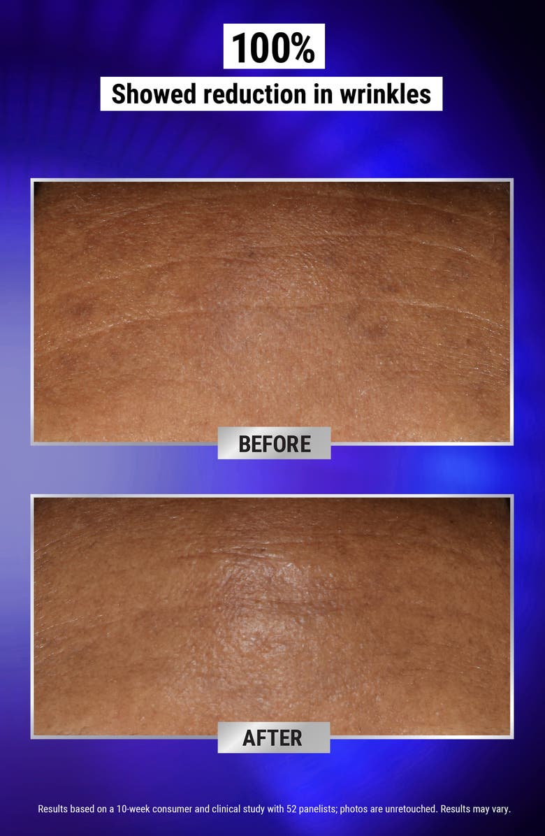 Kiehl's Since 1851 Fast Release Retinol Serum, Alternate, color,