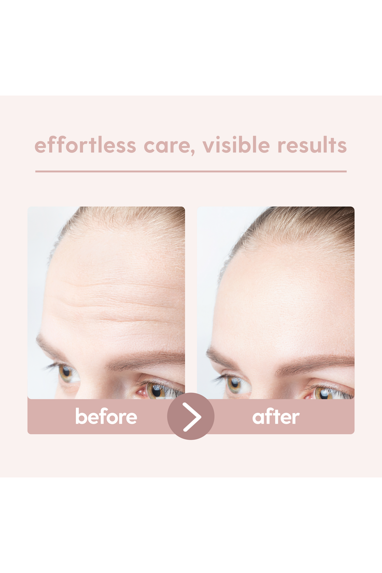 Migraine Forehead Pads, 2ct, Alternate, color, None
