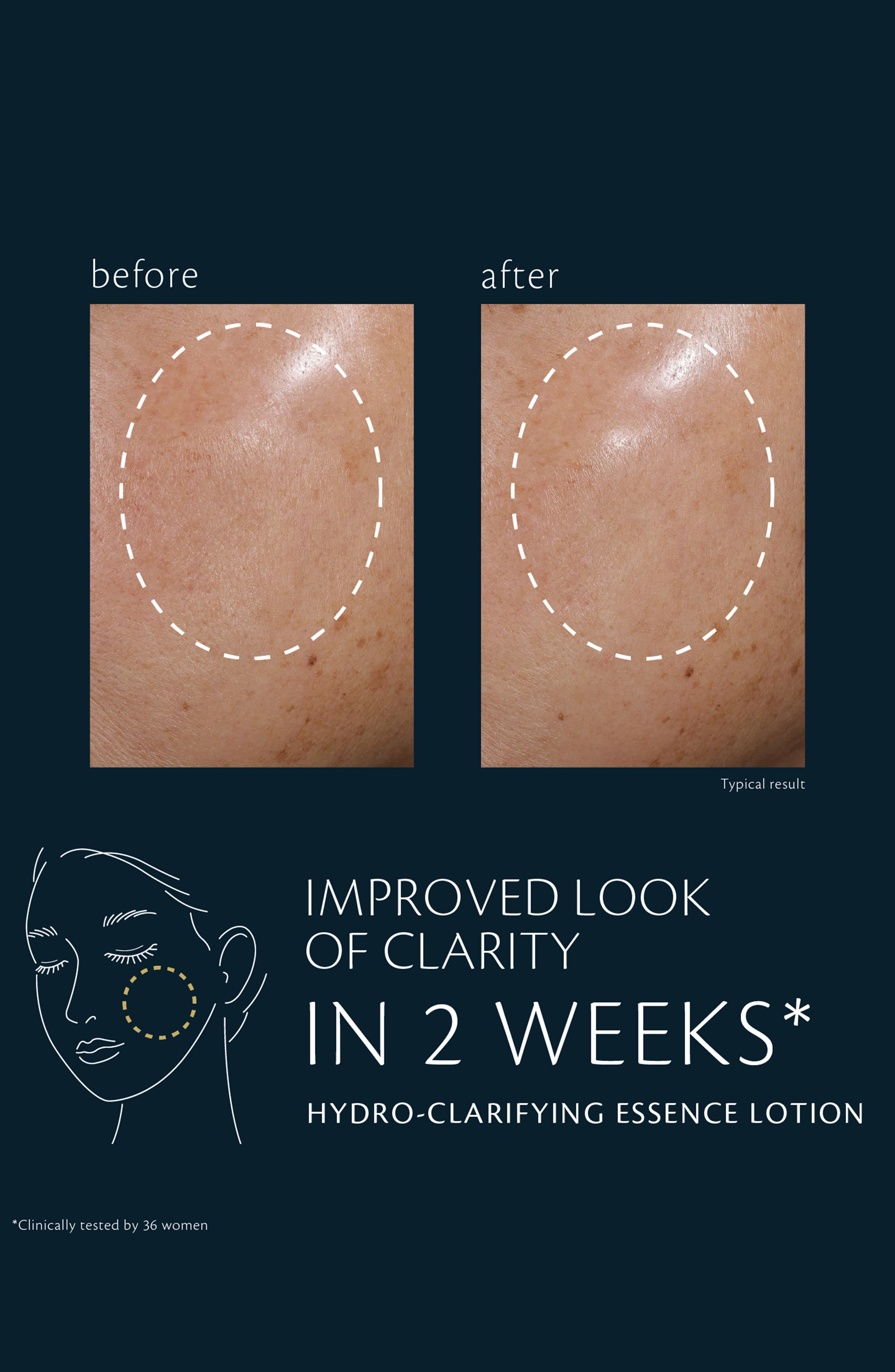 Clé de Peau Beauté Hydro-Clarifying Essence Lotion (Women) | Nordstrom