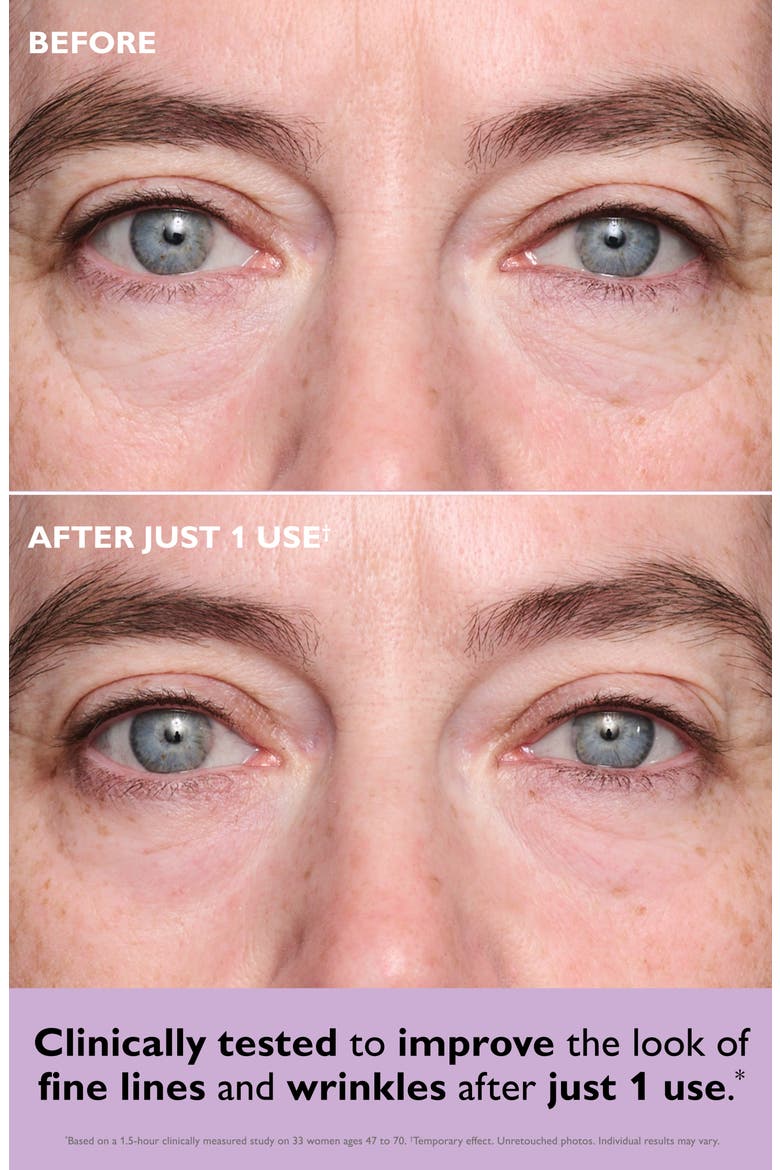 Instant FirmX Collagen-Infusion Tightening Eye Patches, Alternate, color, NO COLOR