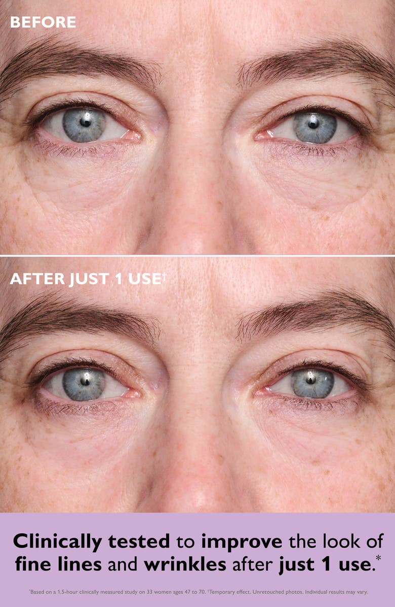 Peter Thomas Roth Instant FIRMx<sup>®</sup> Collagen Tightening Eye Patches, Alternate, color, 