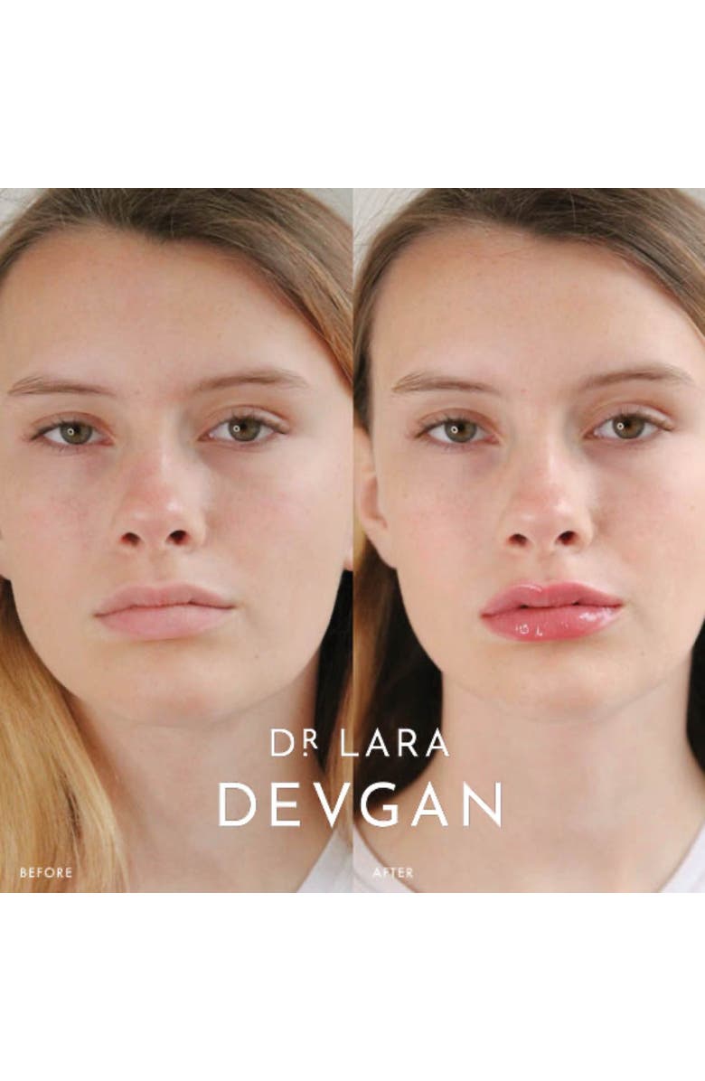 Dr. Devgan Scientific Beauty Vermillion Lip Plump, Alternate, color, Pink