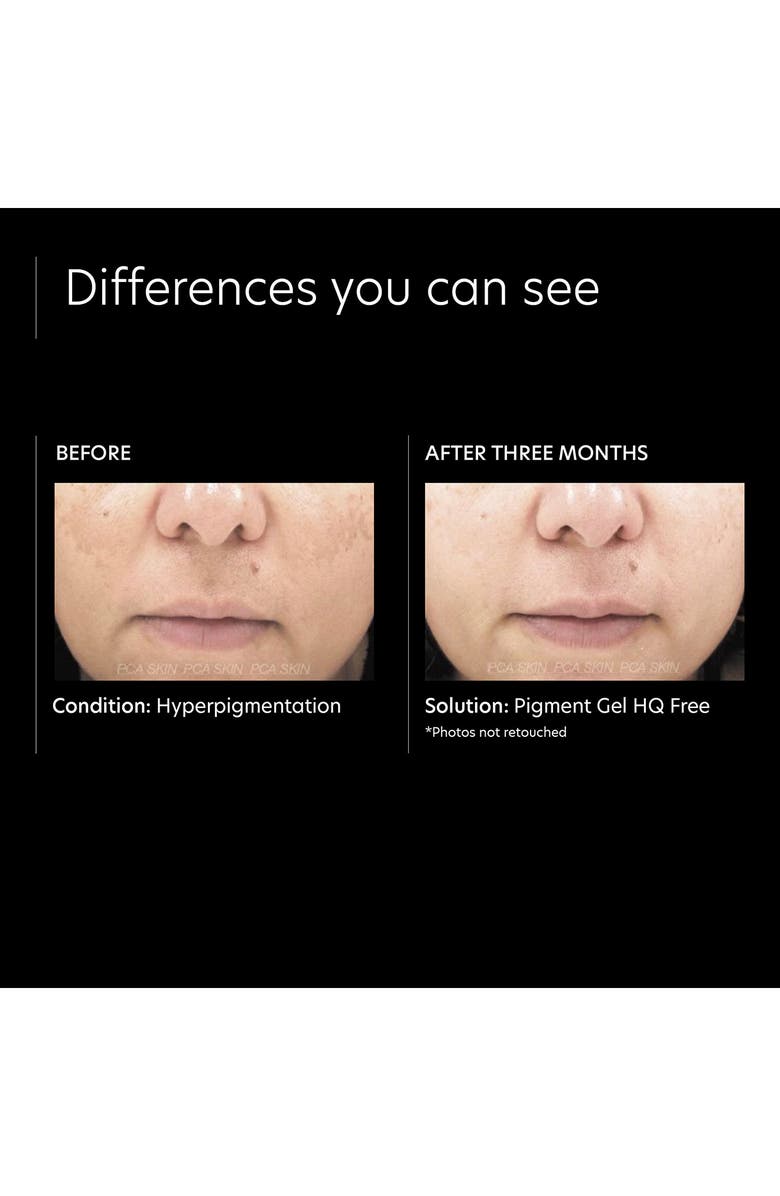 PCA Skin Pigment Gel HQ Free, Alternate, color,