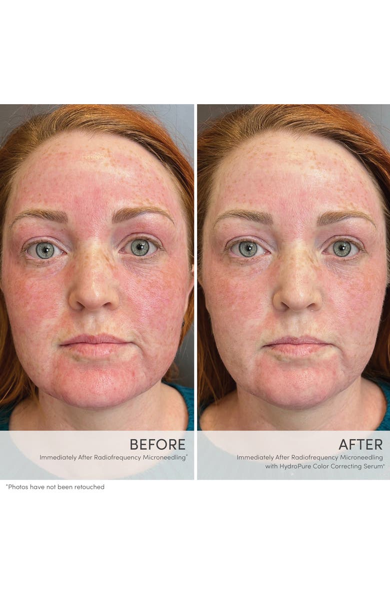 jane iredale HydroPure Color Correcting Serum, Alternate, color,