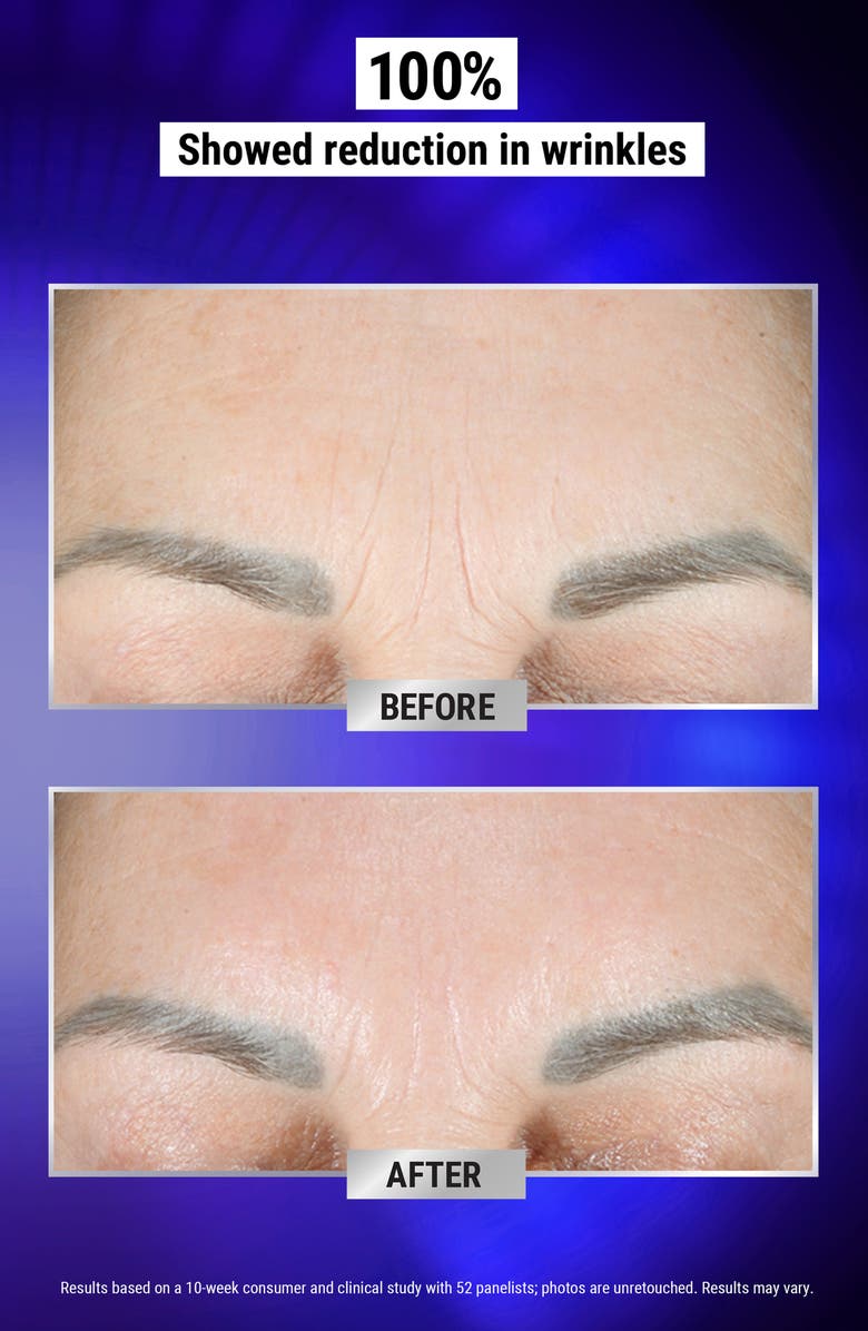 Kiehl's Since 1851 Fast Release Retinol Serum, Alternate, color,