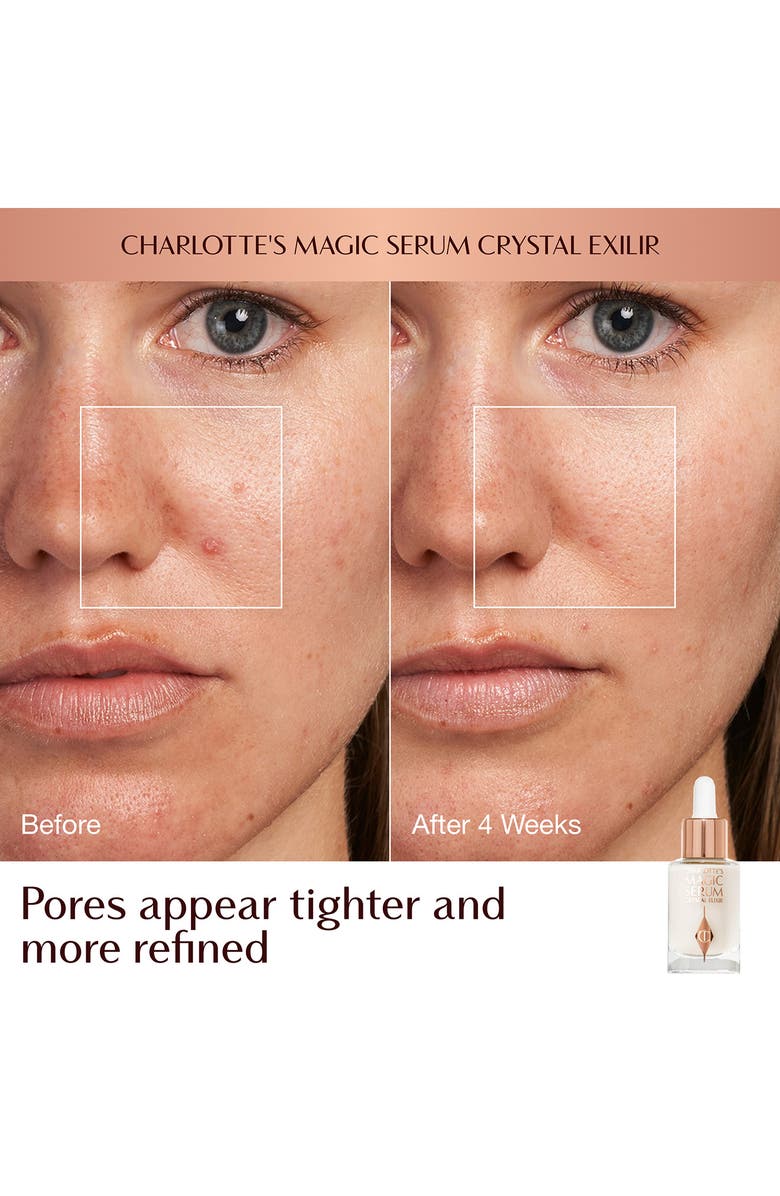 Charlotte Tilbury Immediate Skin Revival + Flawless Base Kit (Nordstrom Exclusive) $87 Value, Alternate, color, 