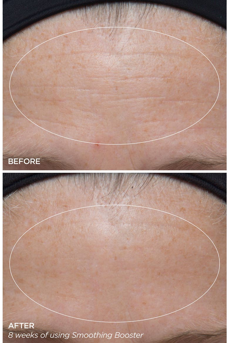 Smoothing Booster, Alternate, color, NO COLOR