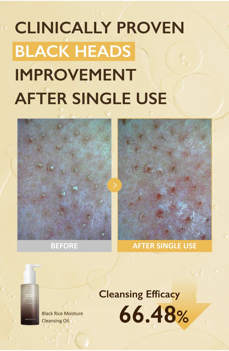 haruharu wonder Cleanse & Glow Set, Alternate, color, NO COLOR