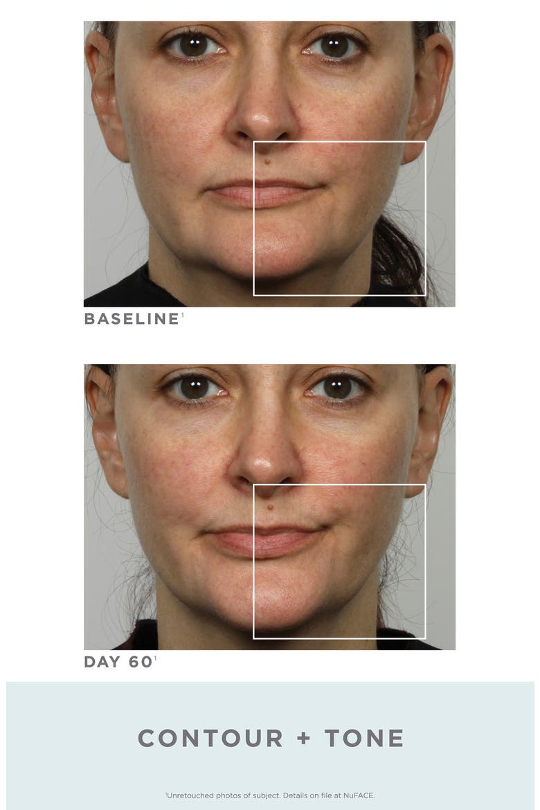 Trinity Facial Toning Device, Alternate, color, NO COLOR