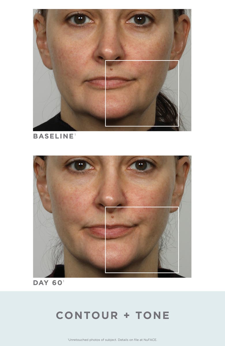 NuFACE<sup>®</sup> Trinity Facial Toning Device, Alternate, color,