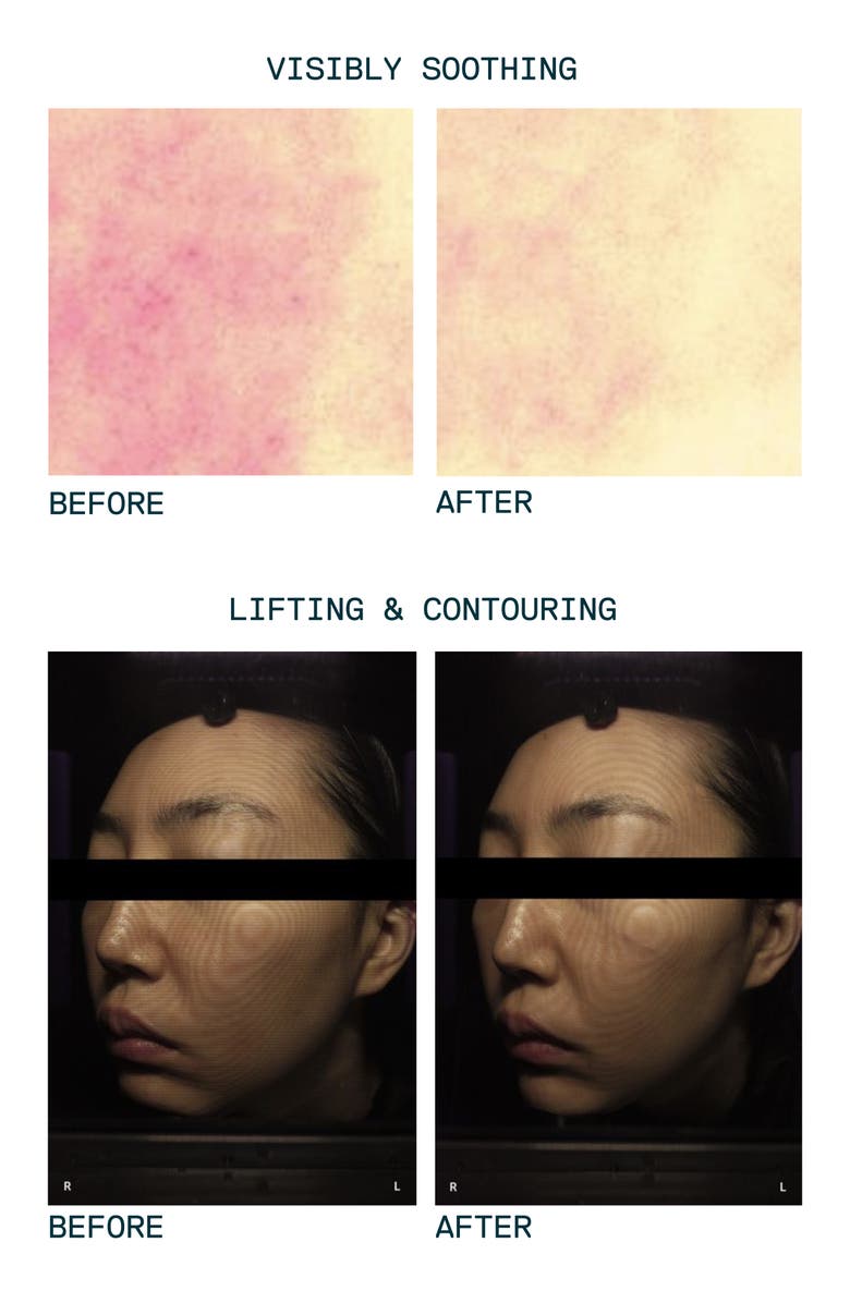 VENN SKINCARE Probiotics Cica Complex Biome Booster Serum, Alternate, color, 