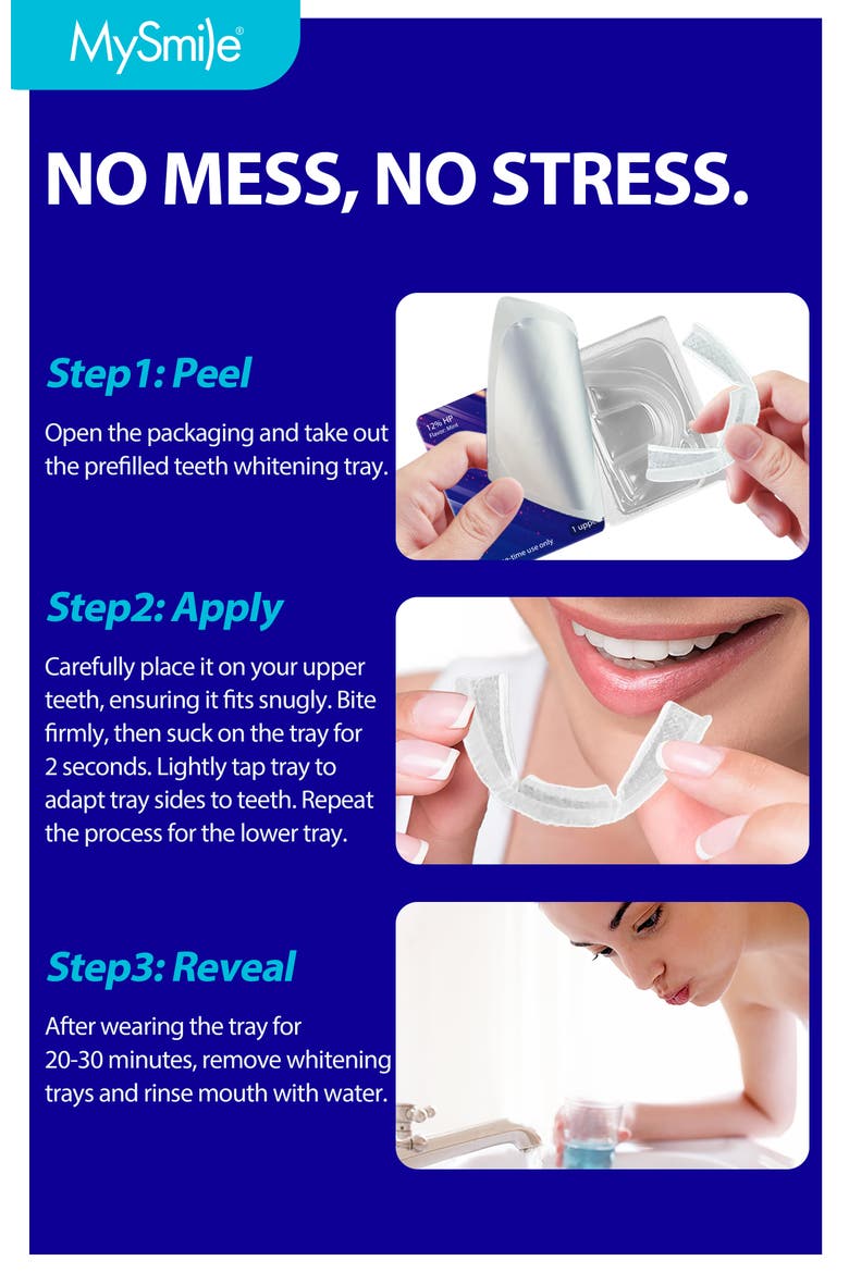 Prefilled Teeth Whitening Trays Kit, 12% Hydrogen Peroxide, Alternate, color, Purple