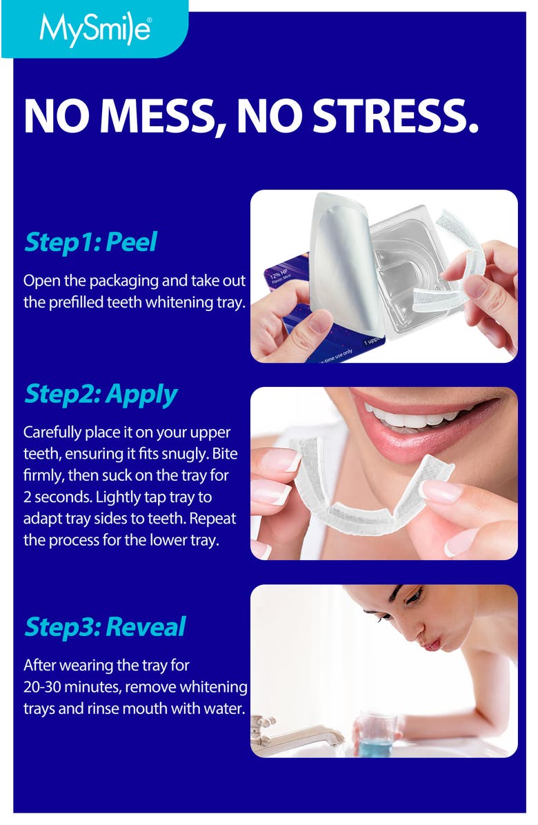 MySmile Prefilled Teeth Whitening Trays Kit, 12% Hydrogen Peroxide, Alternate, color, Purple