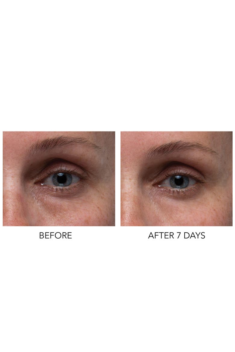 Hyaluronic Marine Dew It Right Eye Gel, Alternate, color, NO COLOR