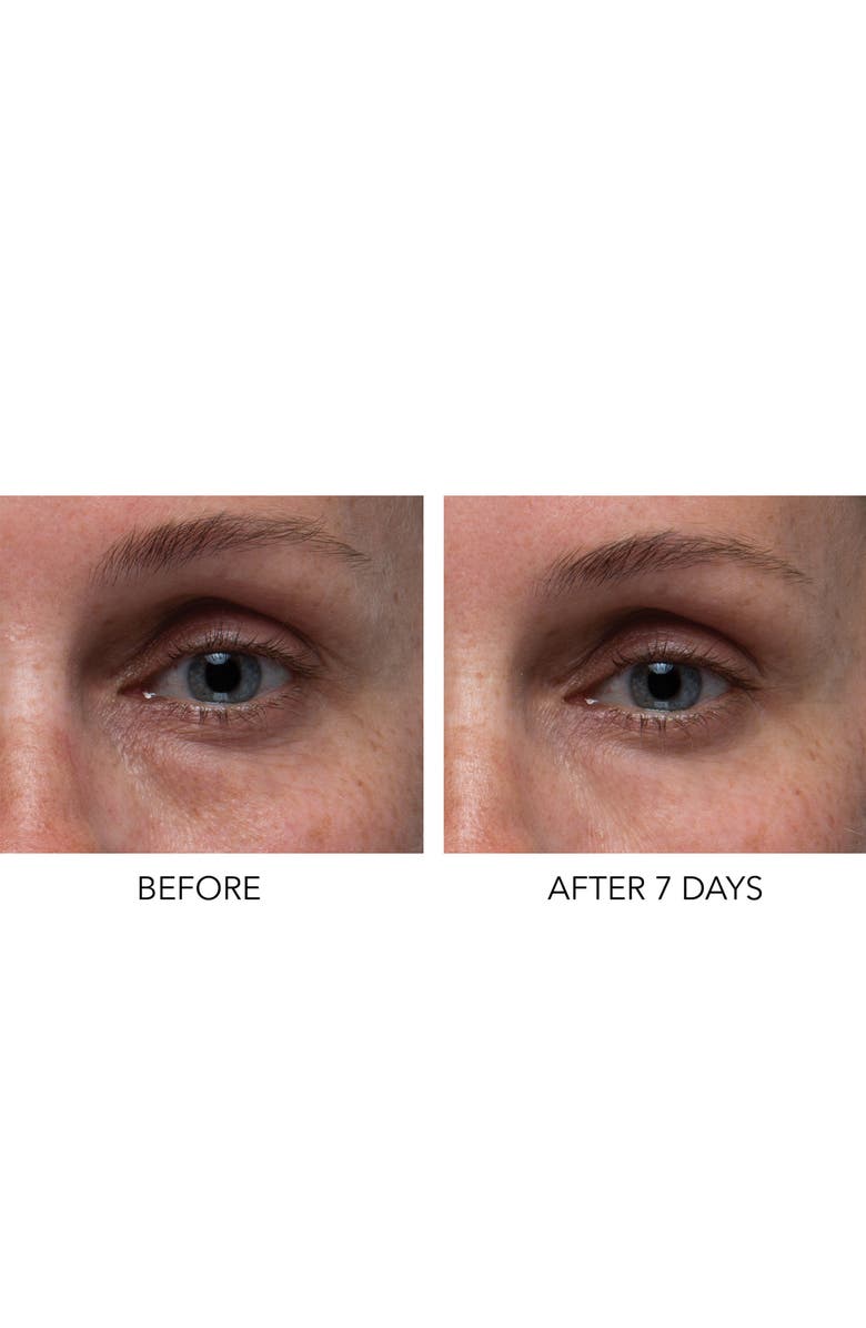 Dr. Dennis Gross Skincare Hyaluronic Marine Dew It Right Eye Gel, Alternate, color,