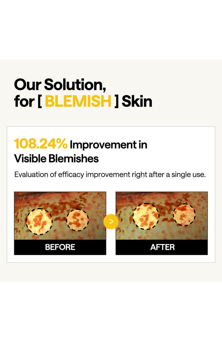 MEDIHEAL Vita Collagen Eye Ampoule Patches, Alternate, color, Yellow