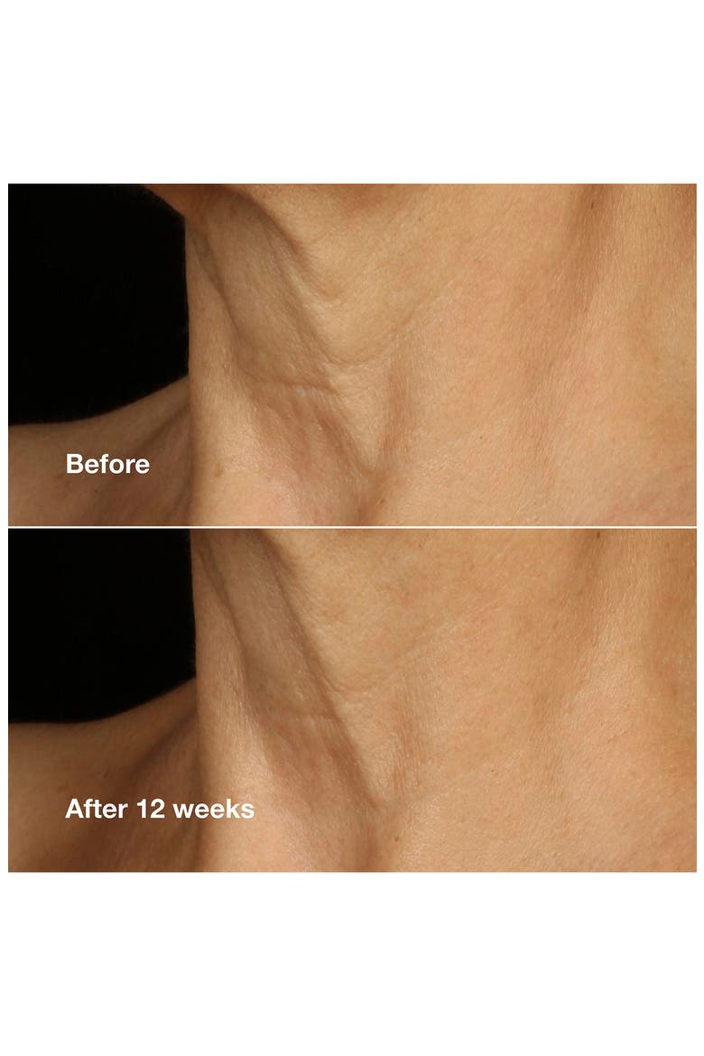 Smart Clinical Repair Lifting Face + Neck Cream, Alternate, color, NO COLOR