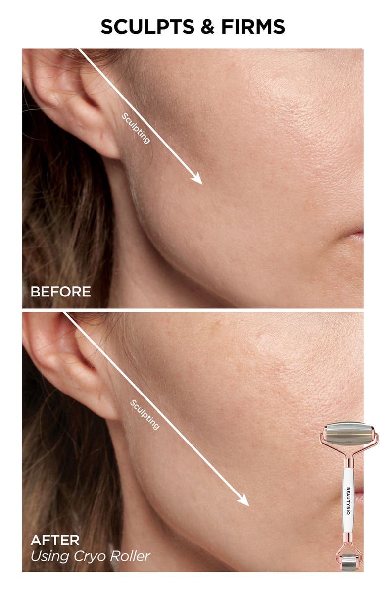 BeautyBio Cryo Facial Set $214 Value, Alternate, color,