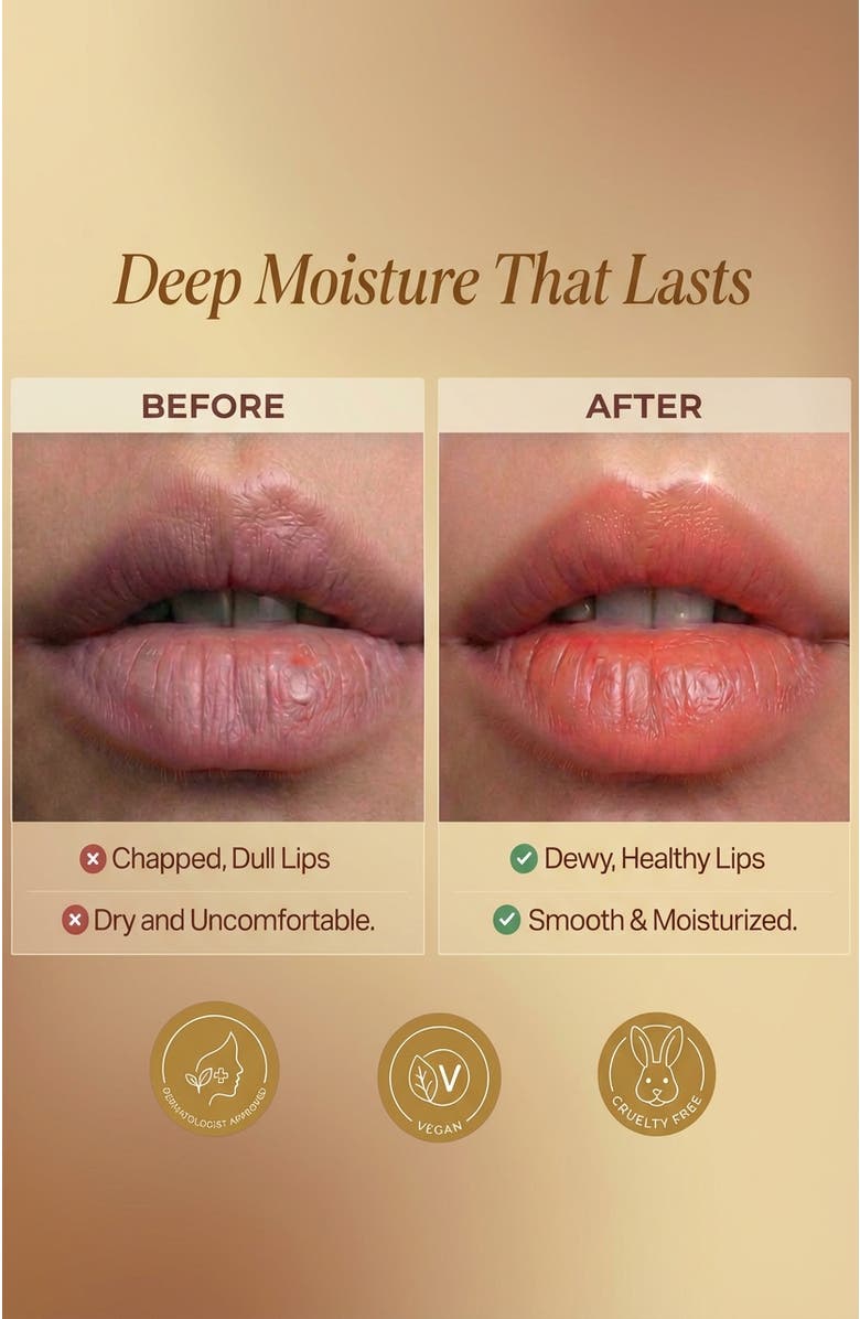 Lovery Korean Skincare Kiss Me Lip Balm Duo Set, Alternate, color, 