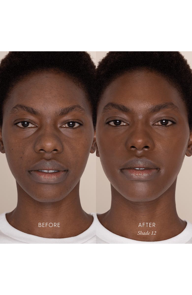 Best Skin Days<sup>™</sup> Treatment Concealer