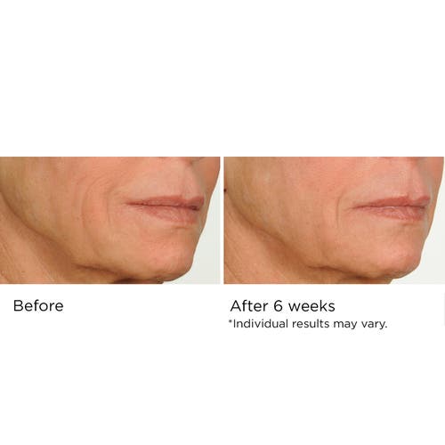 DR. NASSIF SKINCARE DR. NASSIF SKINCARE NIGHT THERAPY SERUM