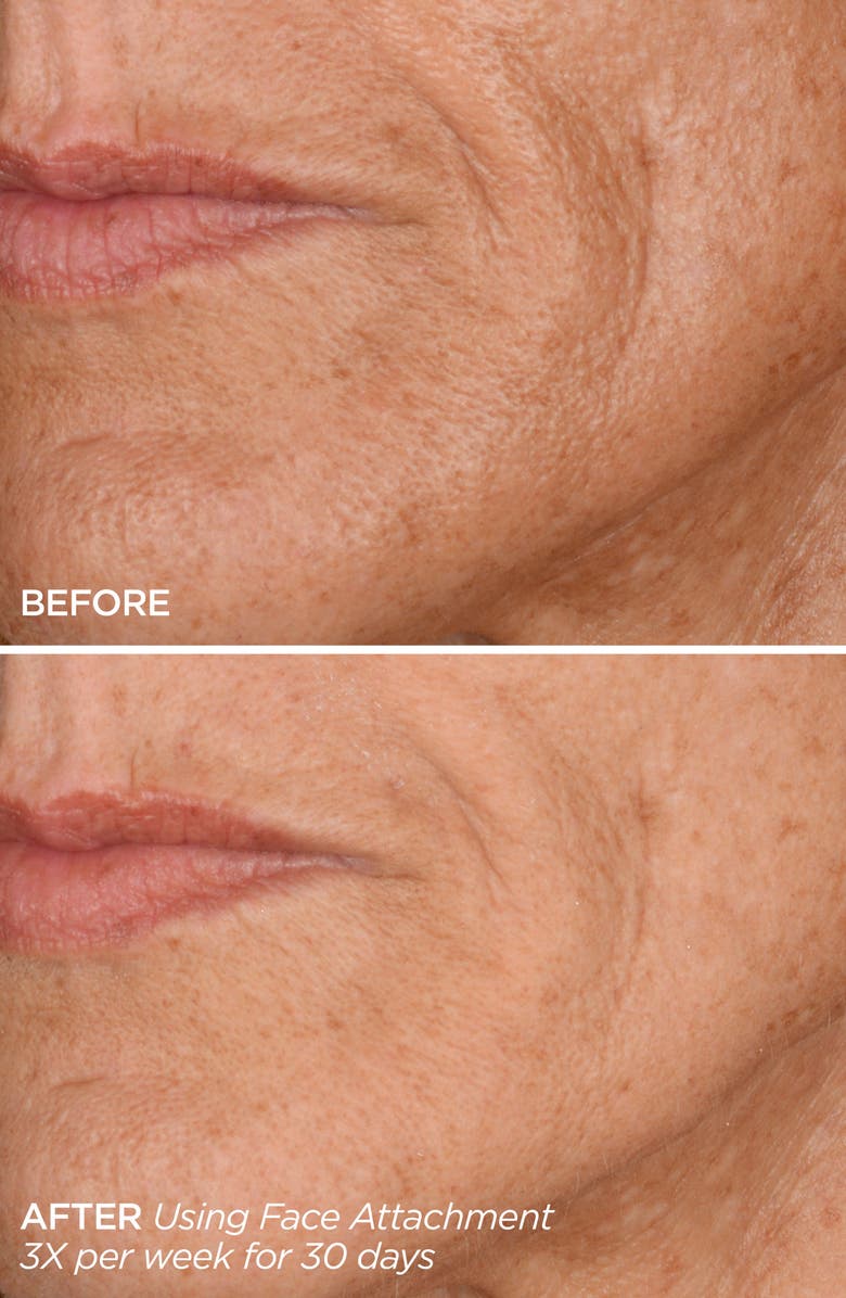 BeautyBio Get That Glow GloPRO<sup>®</sup> Facial Microneedling Discovery Set $233 Value, Alternate, color, 