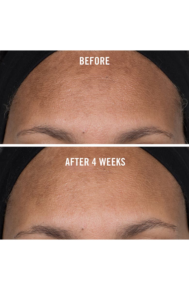 First Aid Beauty Facial Radiance Niacinamide Dark Spot Serum, Alternate, color,