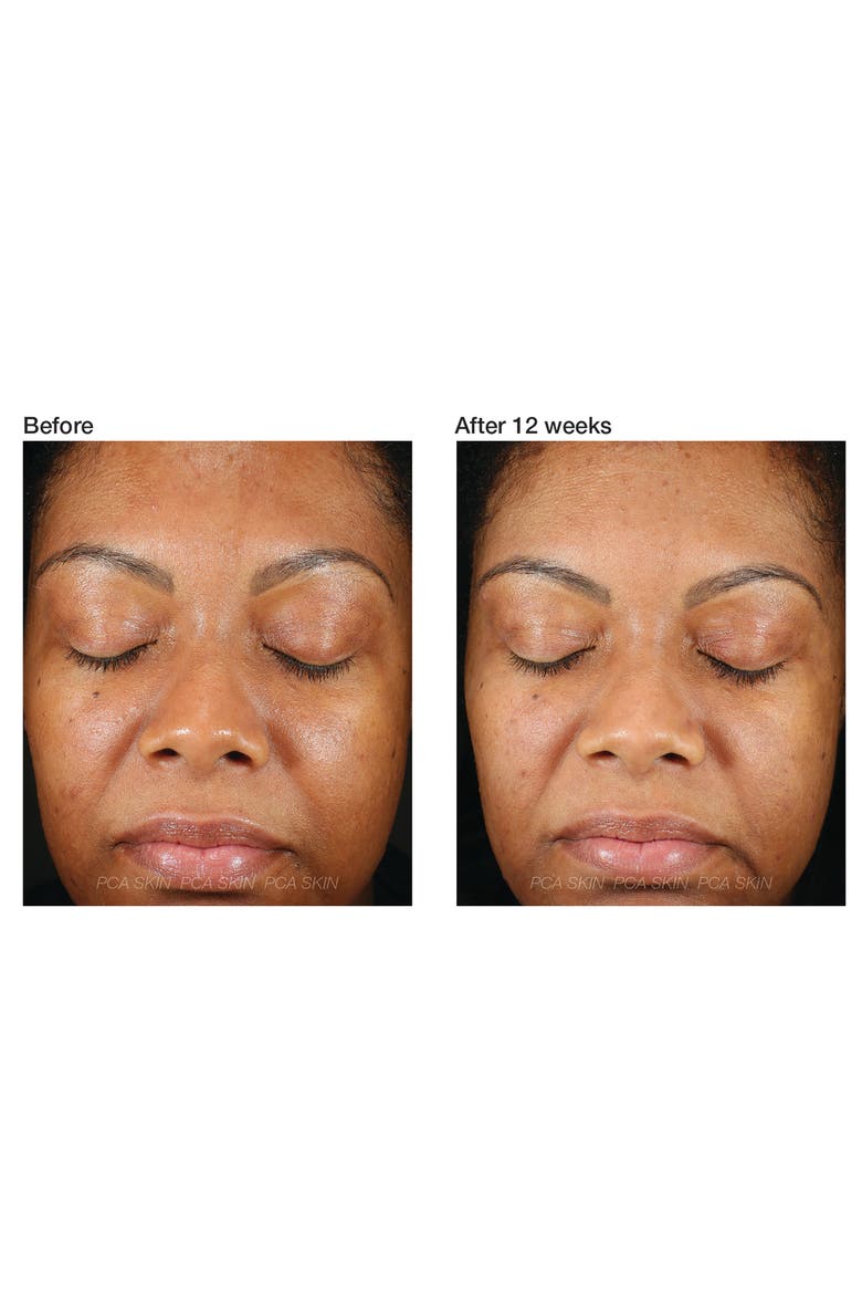 C&E Advanced with Hexylresorcinol and Silymarin Treatment Cream, Alternate, color, NO COLOR
