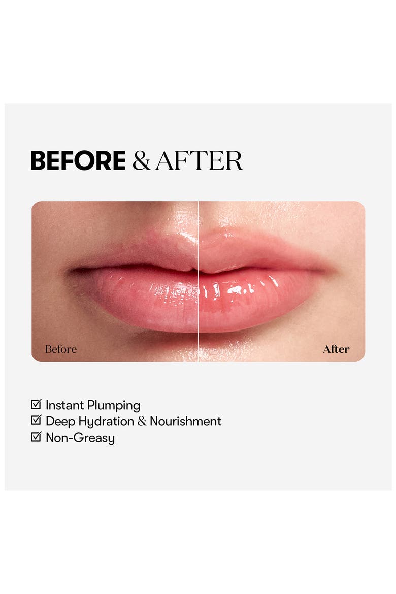 Reedle Shot Lip Plumper Beginner, Alternate, color, SILVER