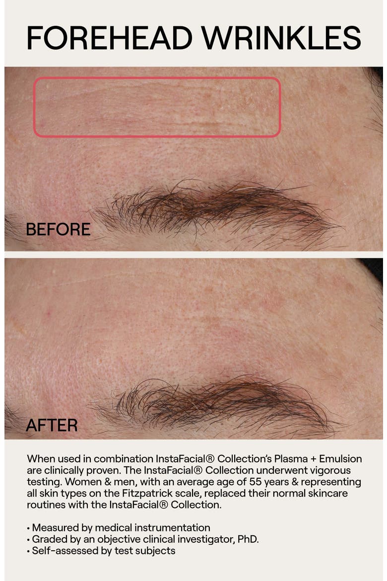 Instafacial® Plasma Serum Duo $400 Value, Alternate, color, NO COLOR