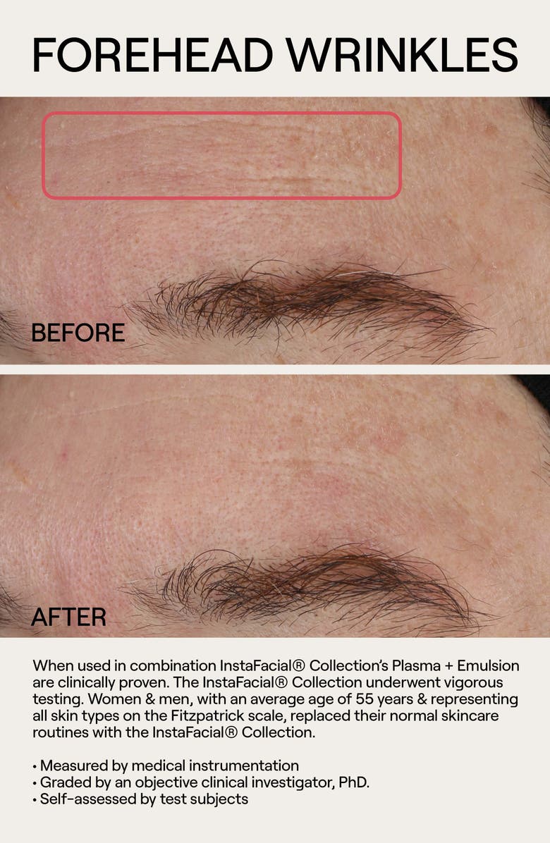 Dr. Diamond's Metacine Instafacial<sup>®</sup> Plasma Serum Duo $400 Value, Alternate, color, 