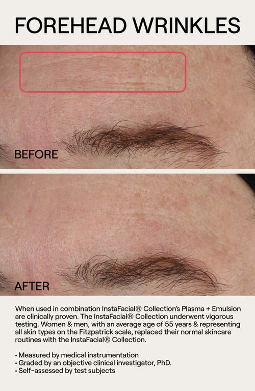 Dr. Diamond’s Metacine Dr. Diamond's Metacine Instafacial® Plasma Serum Duo $400 Value
