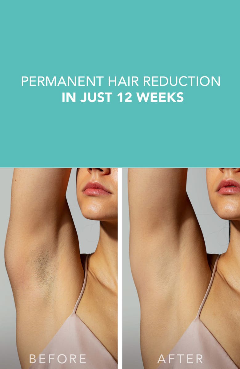 FOREO PEACH<sup>™</sup> 2 IPL Hair Removal Device & Prep Gel Bundle, Alternate, color, 