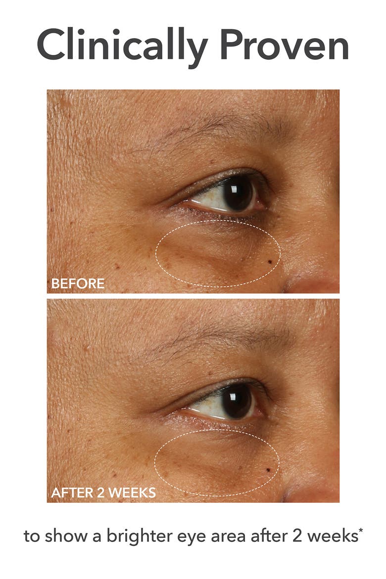 DermInfusions™ Fill + Repair Eye Cream, Alternate, color, NO COLOR