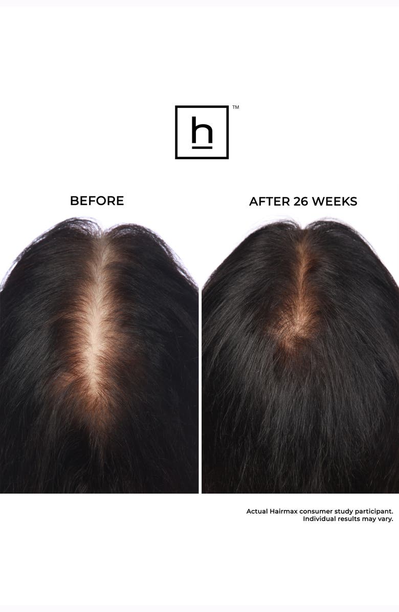 HAIRMAX<sup>®</sup> LaserBand 41 ComfortFlex Hair Growth Device, Alternate, color, Blue