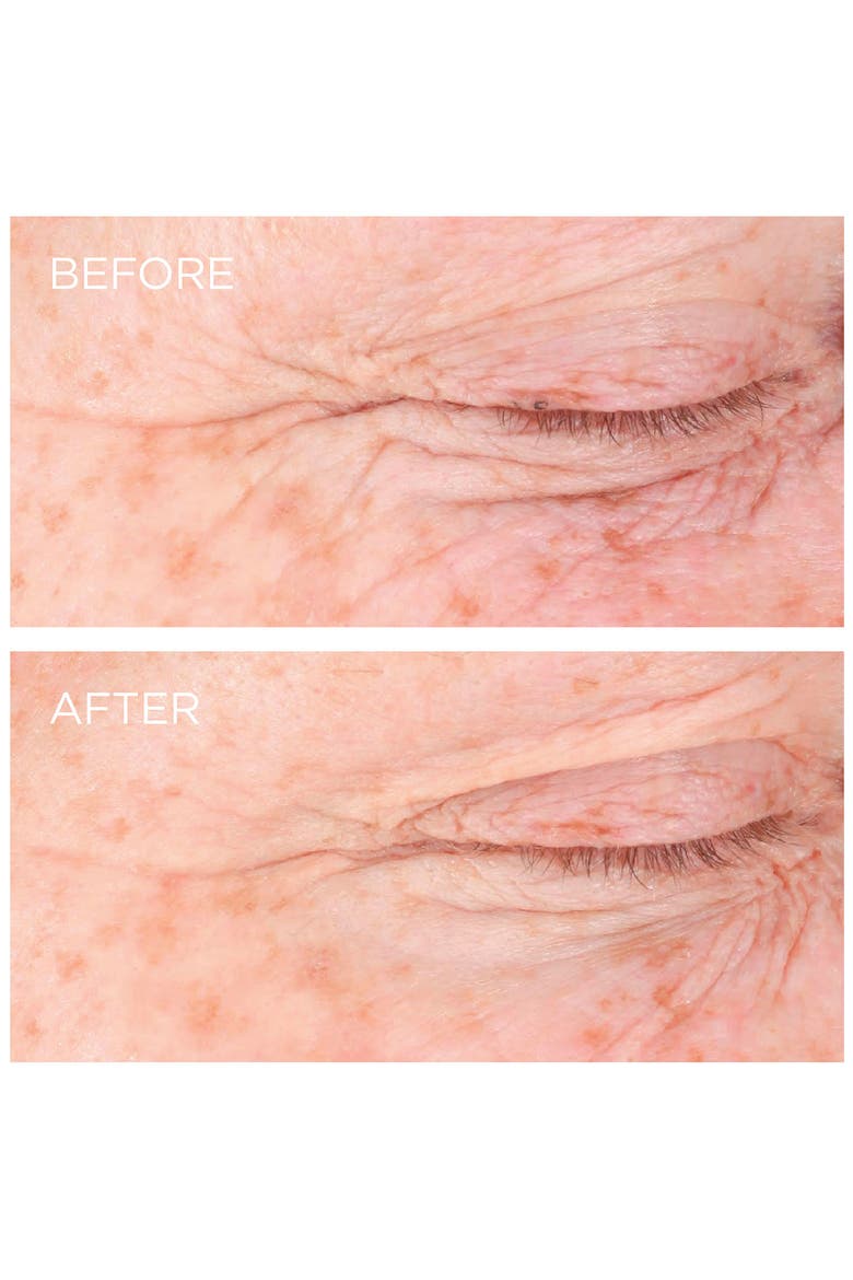 Dermarché® Labs 'FullFill' Hyaluronic Acid Topical Wrinkle Filler, Alternate, color, NO COLOR