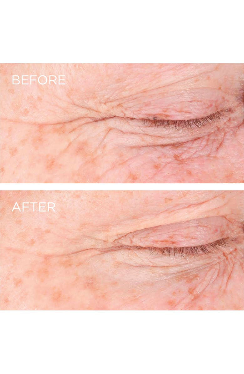 DERMARCHE LABS Dermarché<sup>®</sup> Labs 'FullFill' Hyaluronic Acid Topical Wrinkle Filler, Alternate, color, 