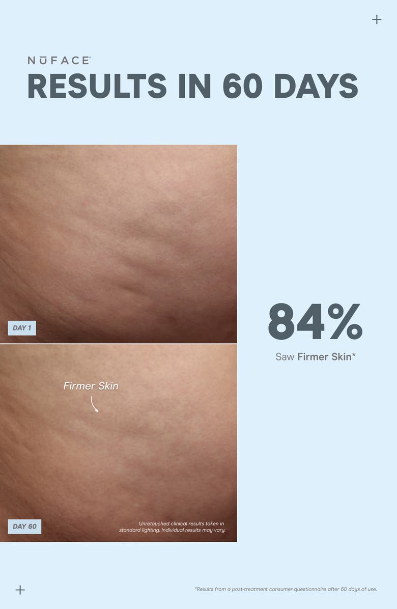 NuFACE<sup>®</sup> NuBODY Skin Toning Microcurrent Device Kit $479 Value, Alternate, color, 