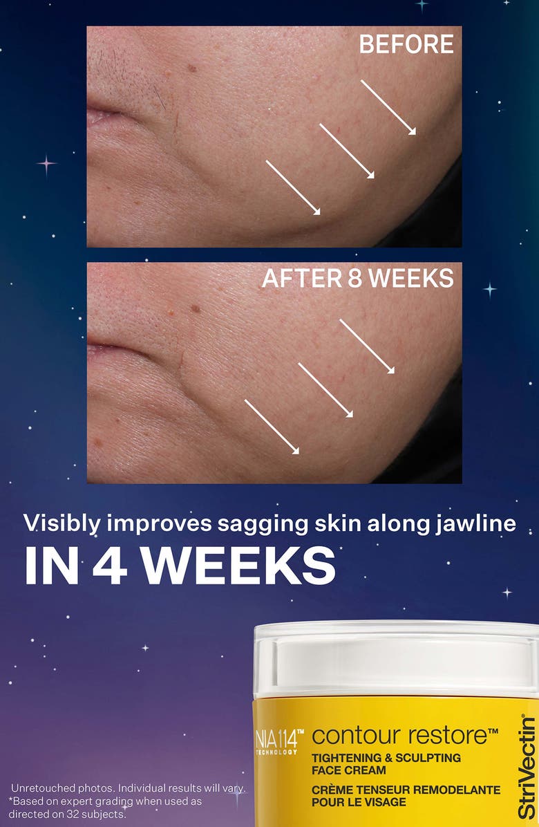 StriVectin<sup>®</sup> Tight & Sculpt Holiday Skin Care Set (Limited Edition) $198 Value, Alternate, color, 