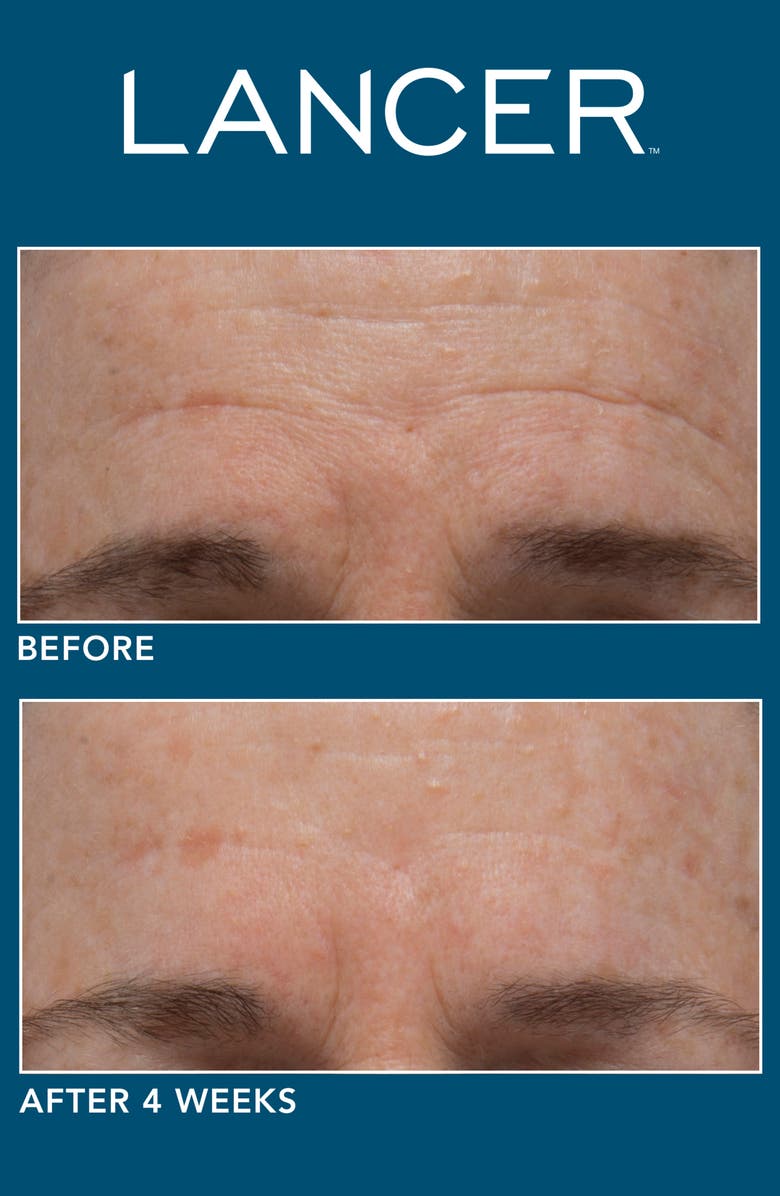 LANCER Skincare The Method Introduction Kit, Alternate, color,