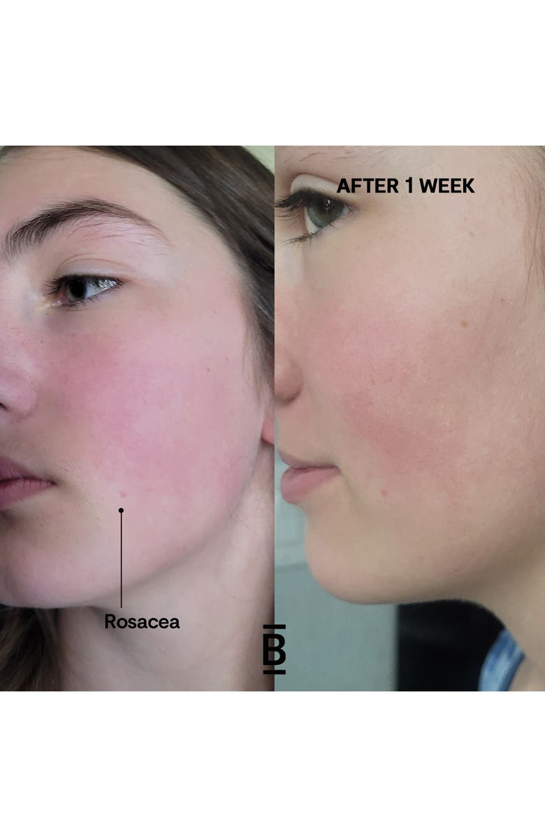 Blossom Essentials Hydration Recovery Face Cream, Alternate, color, NO COLOR