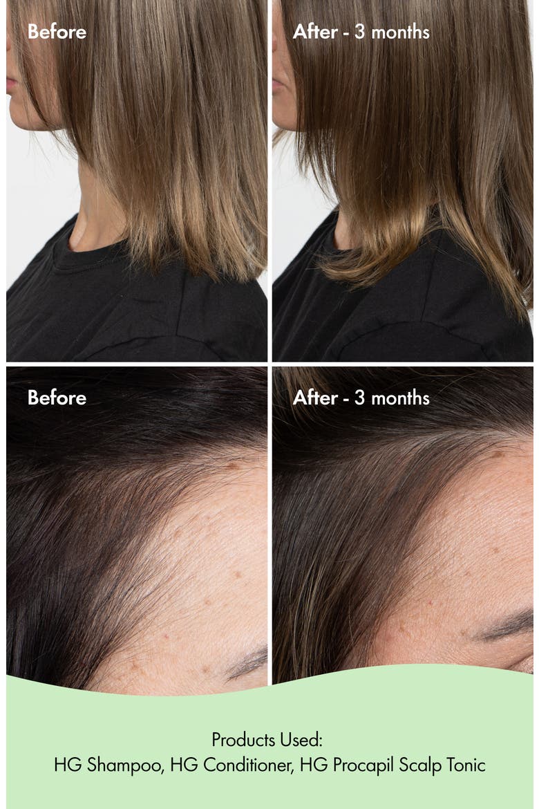 HG Anti-Thinning Conditioner, Alternate, color, NO COLOR