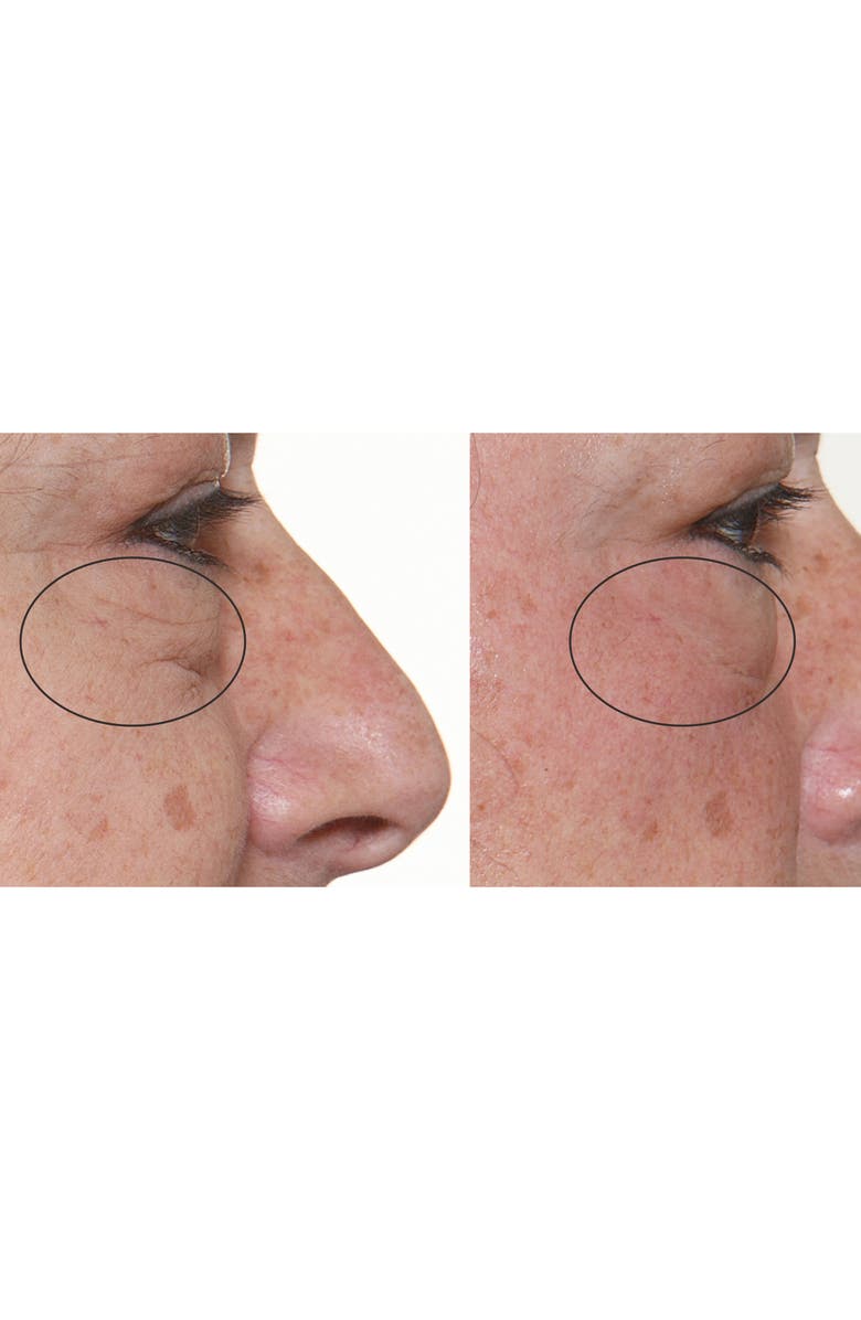 Silk'n FaceFX 360 Anti-Aging Device, Alternate, color, 