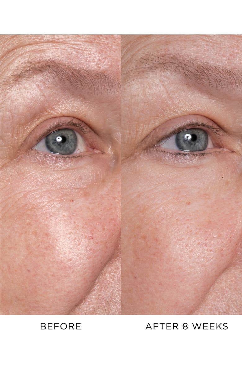 Noble Panacea The Exceptional Eye Lift Concentrate, Alternate, color, White