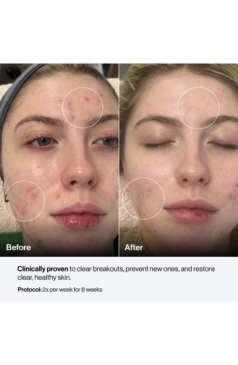 Celluma Nova LED Light Therapy, Alternate, color, Blue