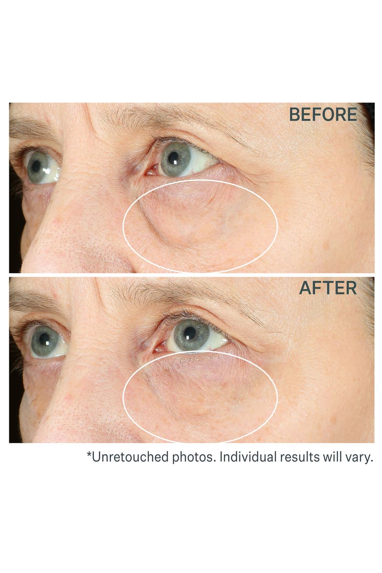 Hyperlift Eye™ Instant Eye Fix Tightening Treatment, Alternate, color, NO COLOR
