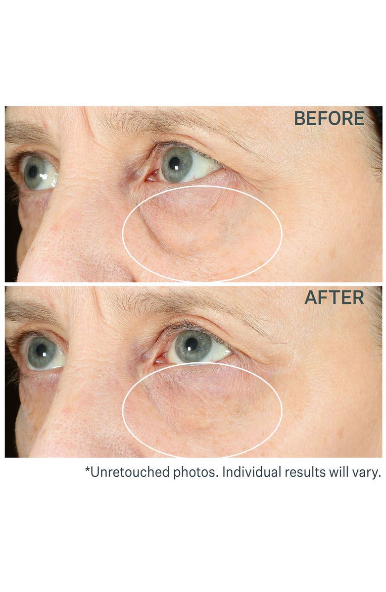 StriVectin<sup>®</sup> Hyperlift Eye<sup>™</sup> Instant Eye Fix Tightening Treatment, Alternate, color,